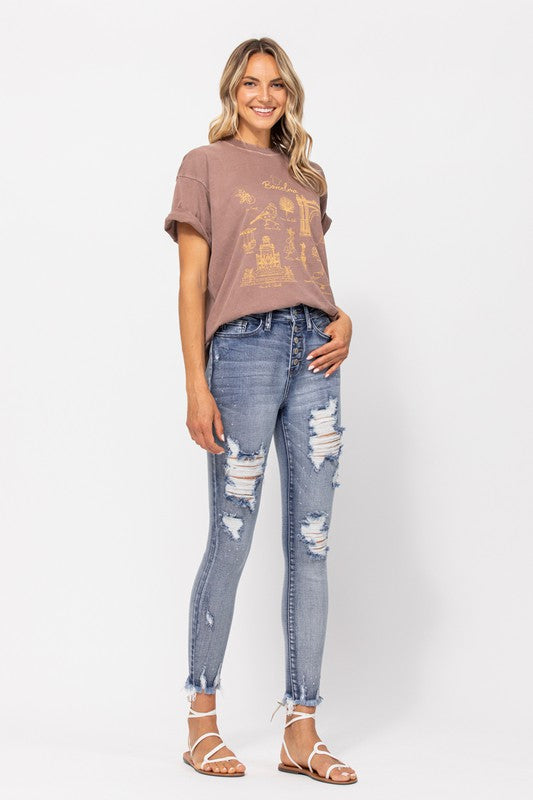 For The Win Skinny Jeans